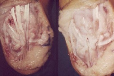 LESION (19)  IMAGENES FOTOS